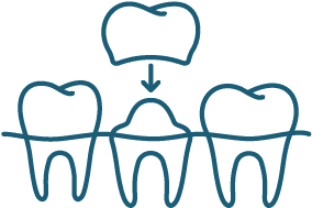 Dental crowns